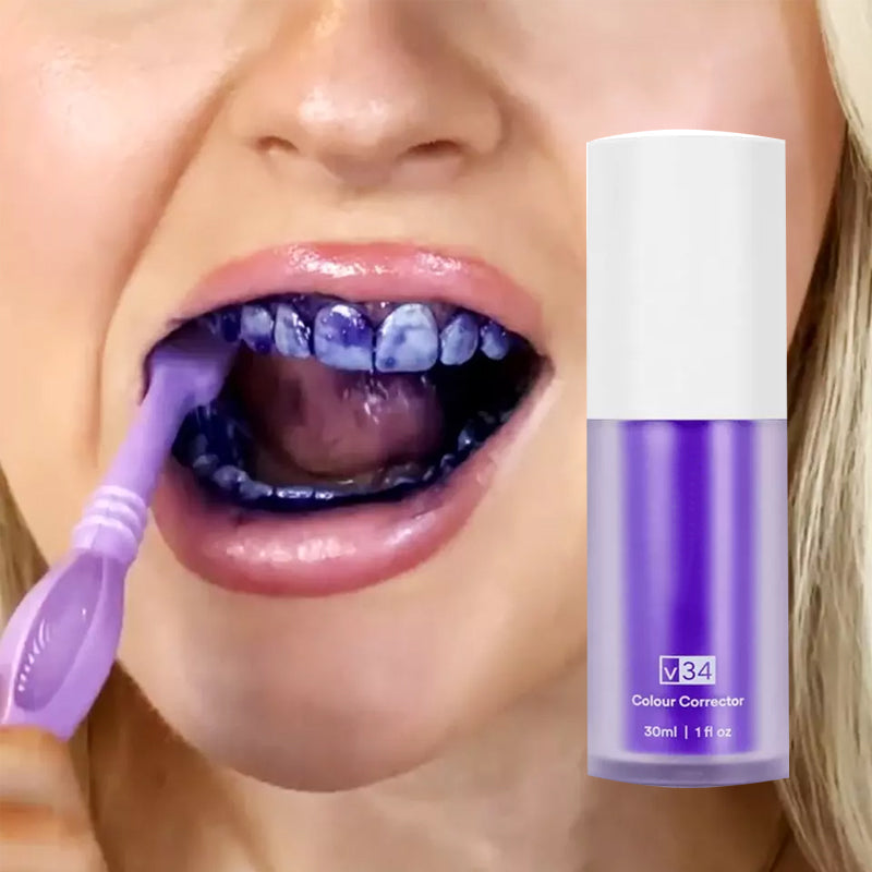 SmileKit – Albire Profesională & Zâmbet Strălucitor™