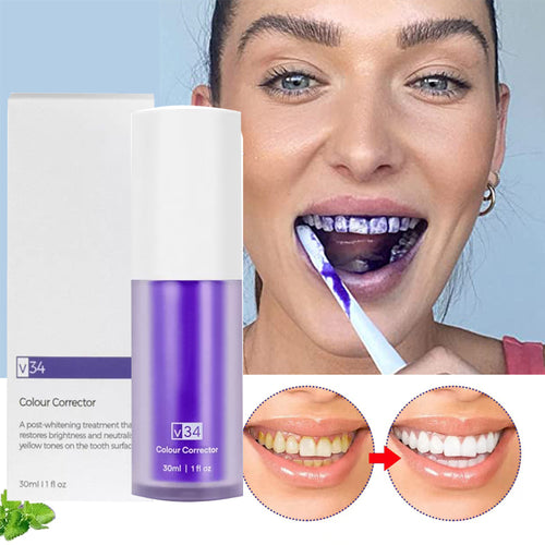 SmileKit – Albire Profesională & Zâmbet Strălucitor™