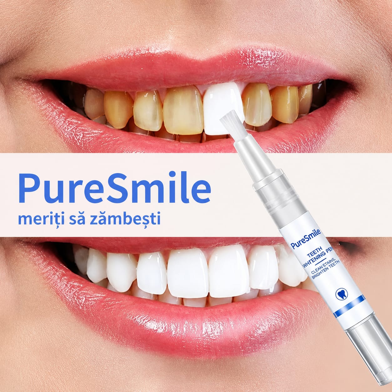 PureSmile - creion de albire dentară