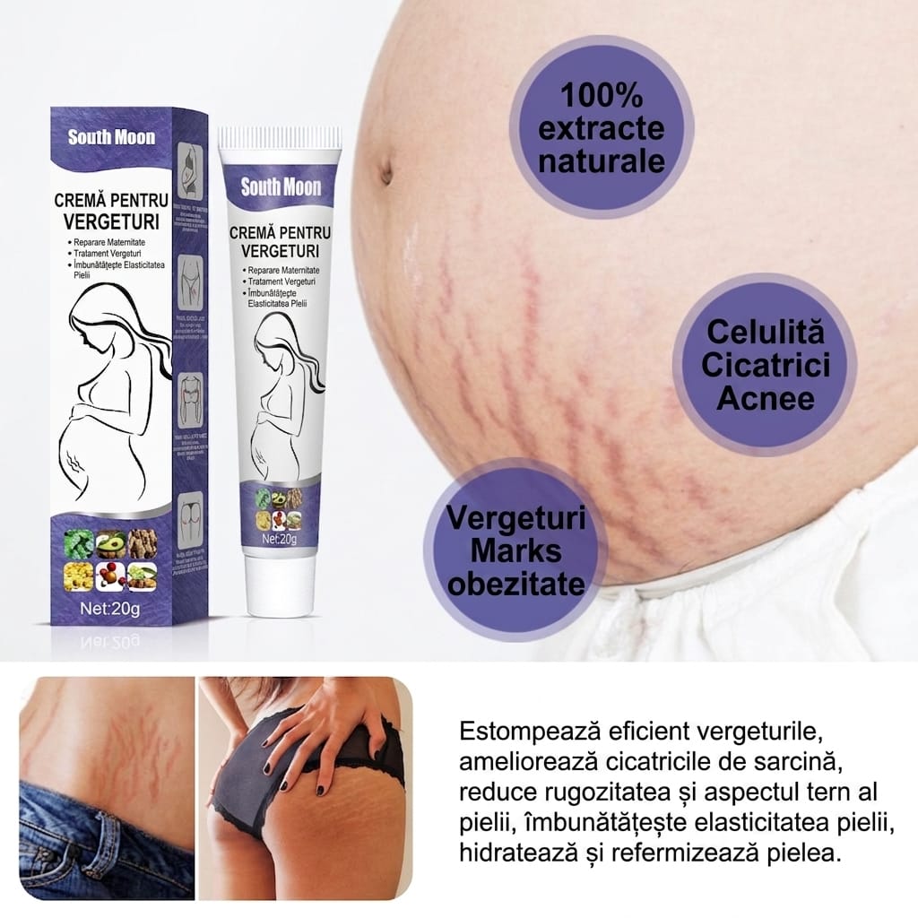Crema Vergeturi – Elasticitate & Fermitate Rapidă™