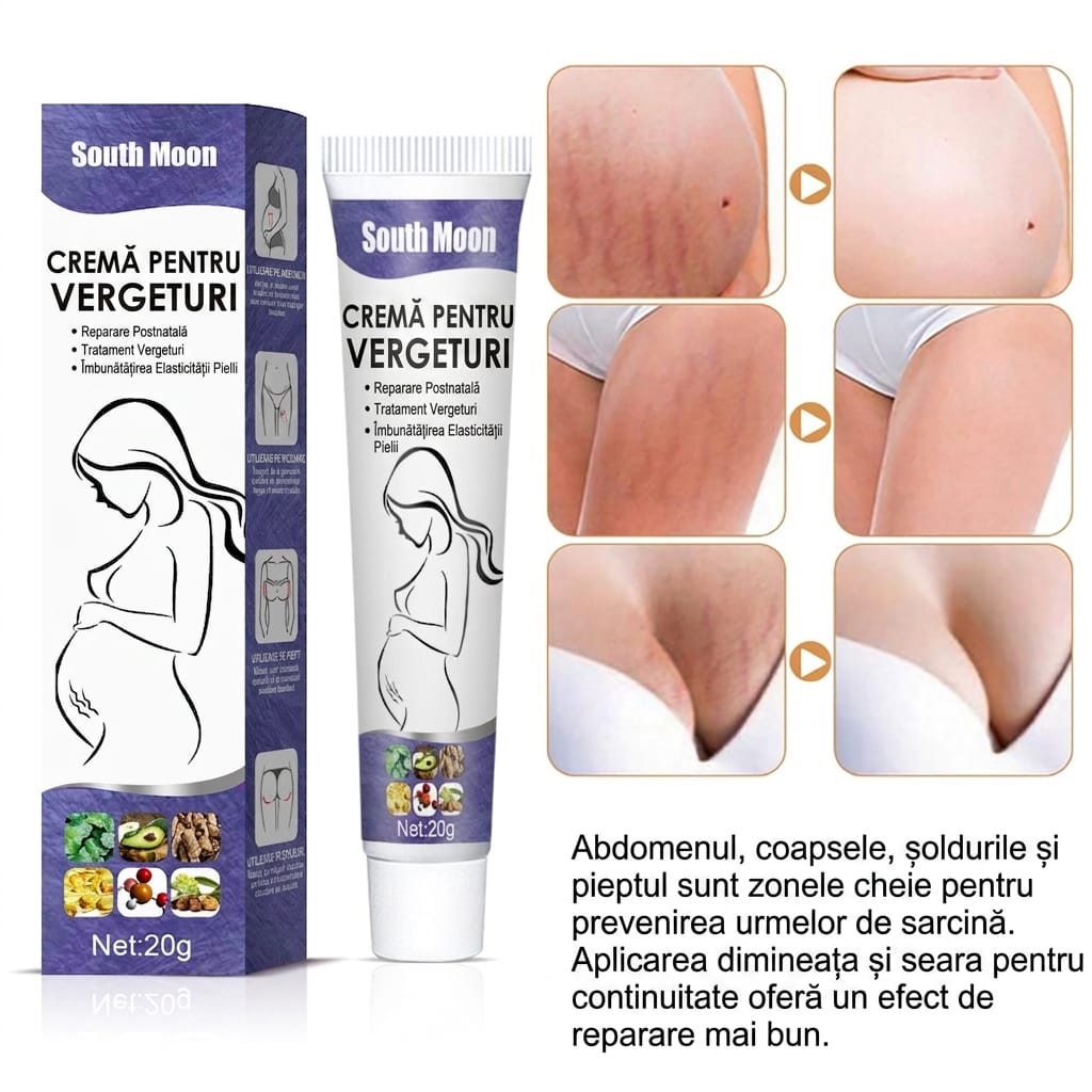 Crema Vergeturi – Elasticitate & Fermitate Rapidă™