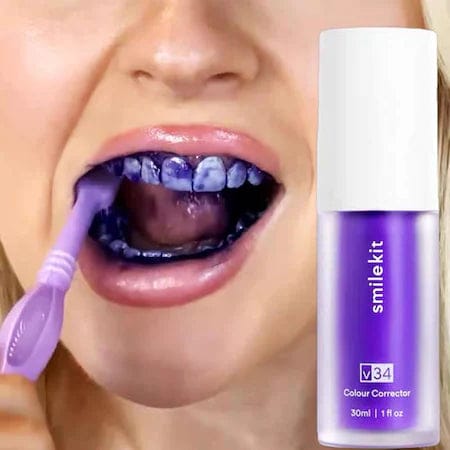 SmileKit™ – Spumă Corectoare pentru Dinți Mai Albi