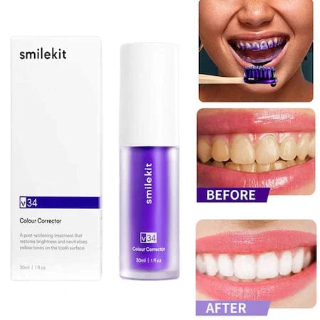 SmileKit™ – Spumă Corectoare pentru Dinți Mai Albi