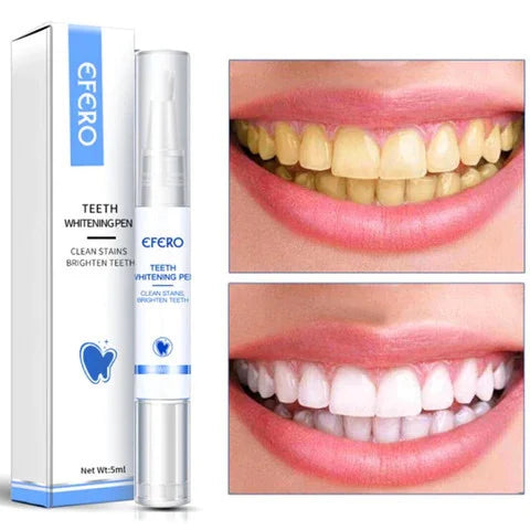 PureSmile - creion de albire dentară